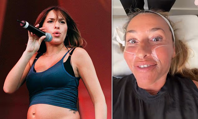 Melanie Blatt showing off her face after cosmetic skin treatment