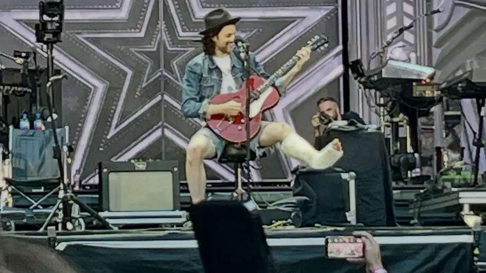 James Bay looks down at his guitar and smiles. He has his leg in plaster propped up on a case. He is wearing shorts and and a denim jacket and hat, perched at an angle on his head.