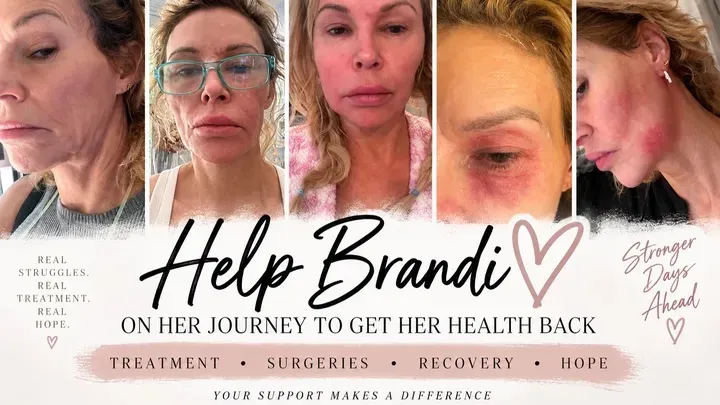 The GoFundMe (screenshot seen above) was started by a friend amid Glanville’s battle with facial disfigurement.