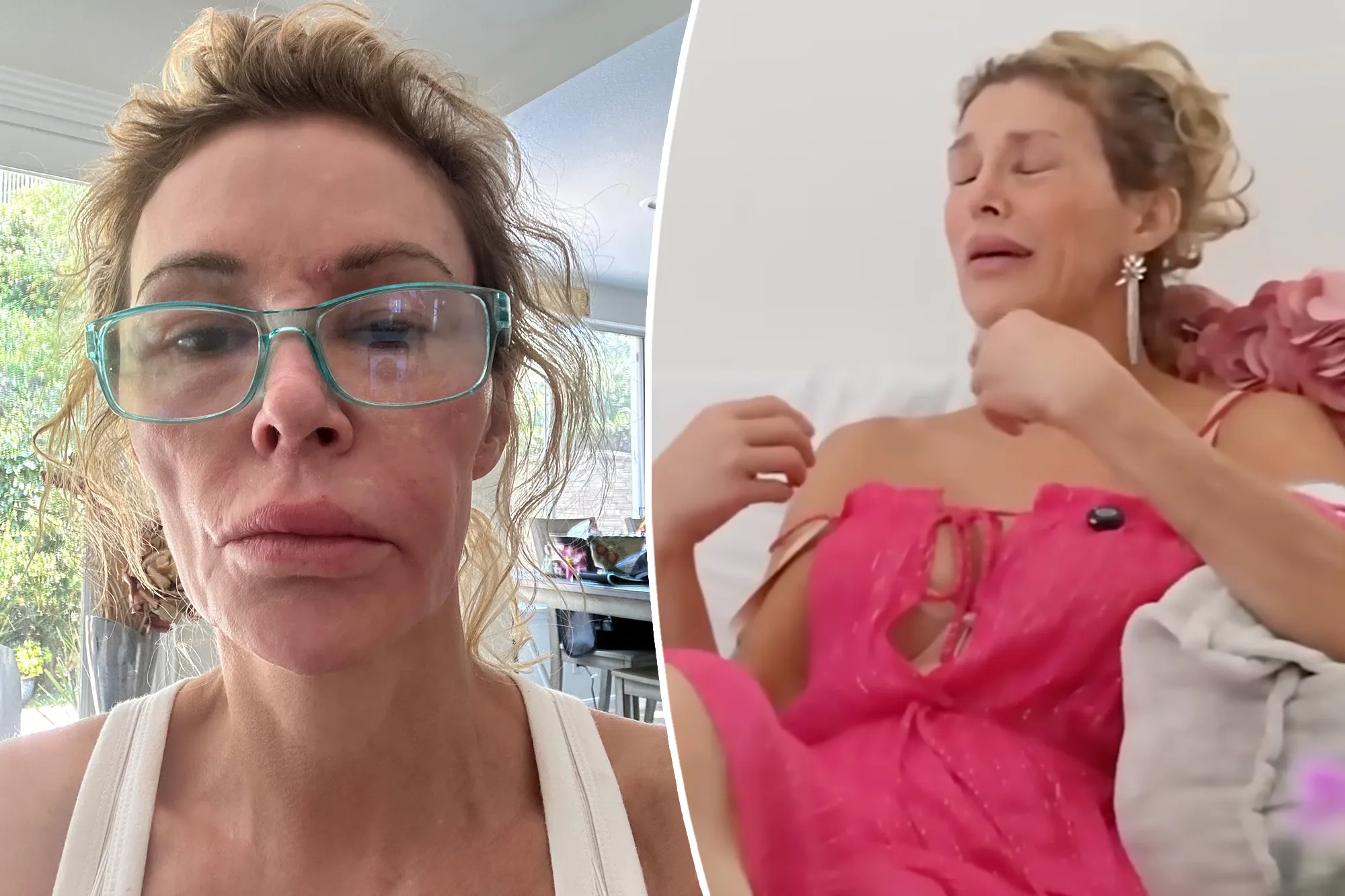 Brandi Glanville speaking out about her health and GoFundMe campaign